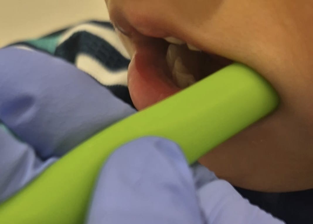 Terapia Miofuncional